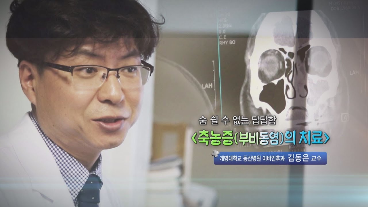 축농증(부비동염)의 치료 - 계명대 동산병원 이비인후과 김동은 교수 - 1