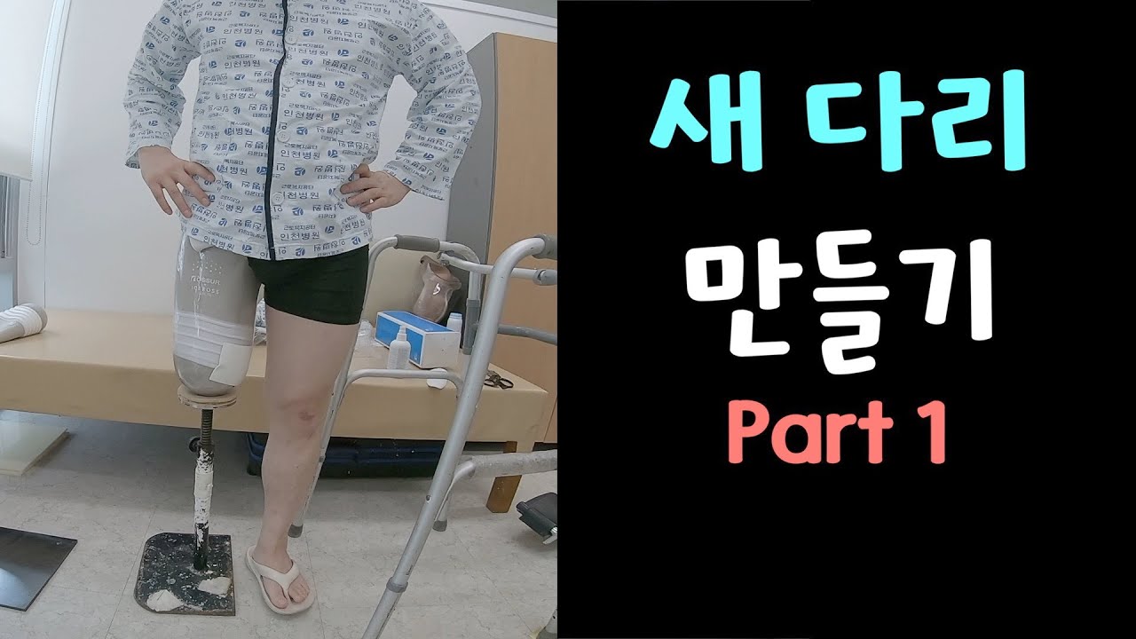 의족 제작 - Part 1