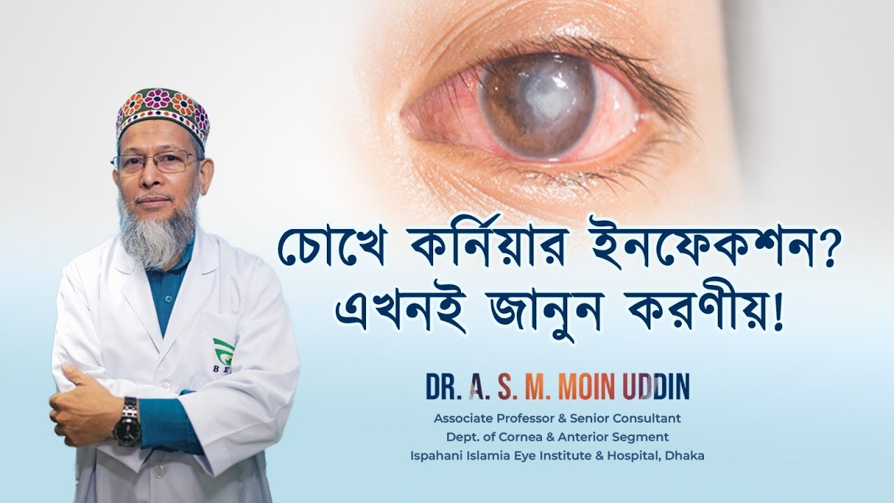 কর্নিয়ার ইনফেকশন: লক্ষণ, কারণ ও কার্যকর চিকিৎসা || Eye Care Tips in Bangla