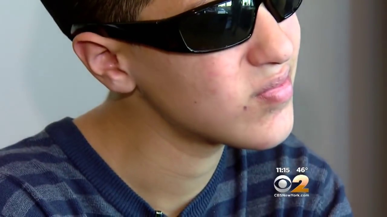 Vape Pen Explodes In Teen&rsquo;s Face