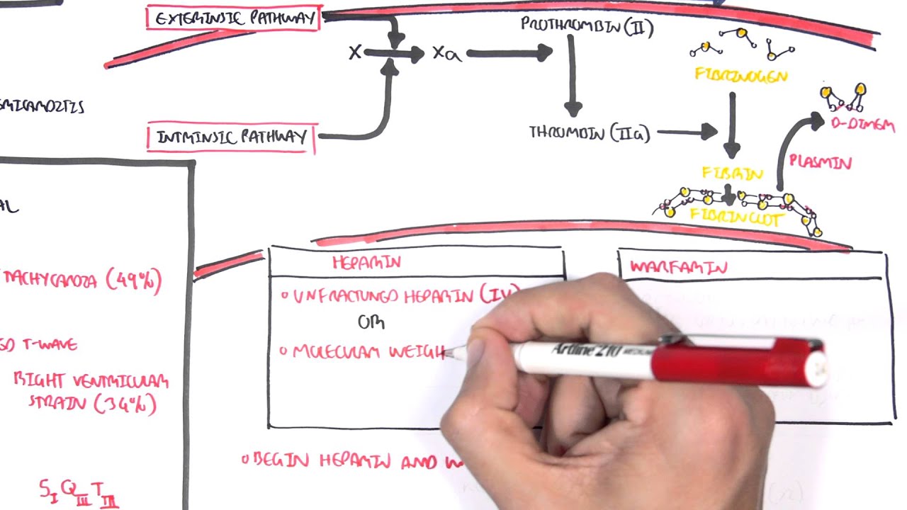 Pulmonary Embolism PART II