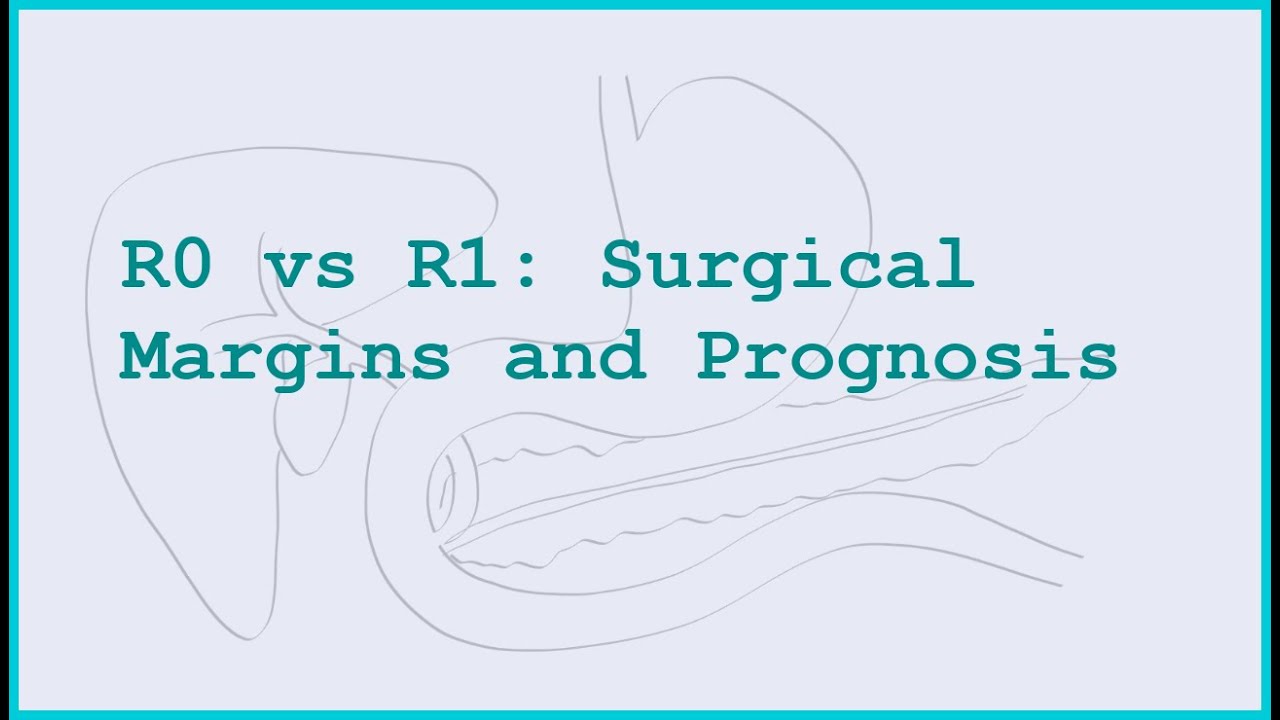 Understanding R0 and R1 Resections: How Surgical Margins Affect Your Prognosis