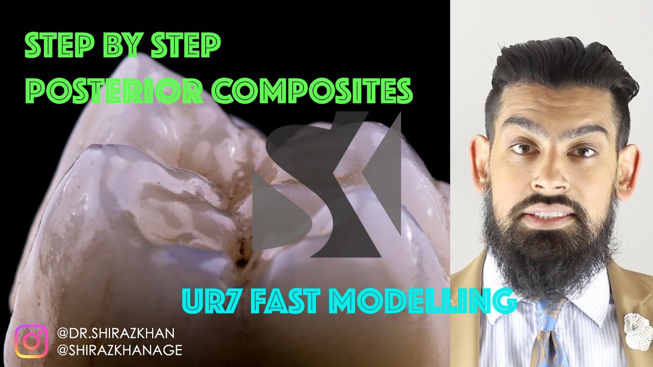 \\ Posterior Composites 2: The Fast Modelling technique step-by-step with Dr. Shiraz Khan