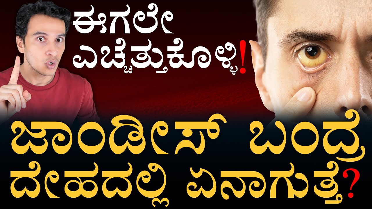 ಎಣ್ಣೆಗೂ ಜಾಂಡೀಸ್‌ಗೂ ಏನ್‌ ಸಂಬಂಧ? | How does jaundice occur? | Bilirubin | Masth Magaa | Amar Prasad