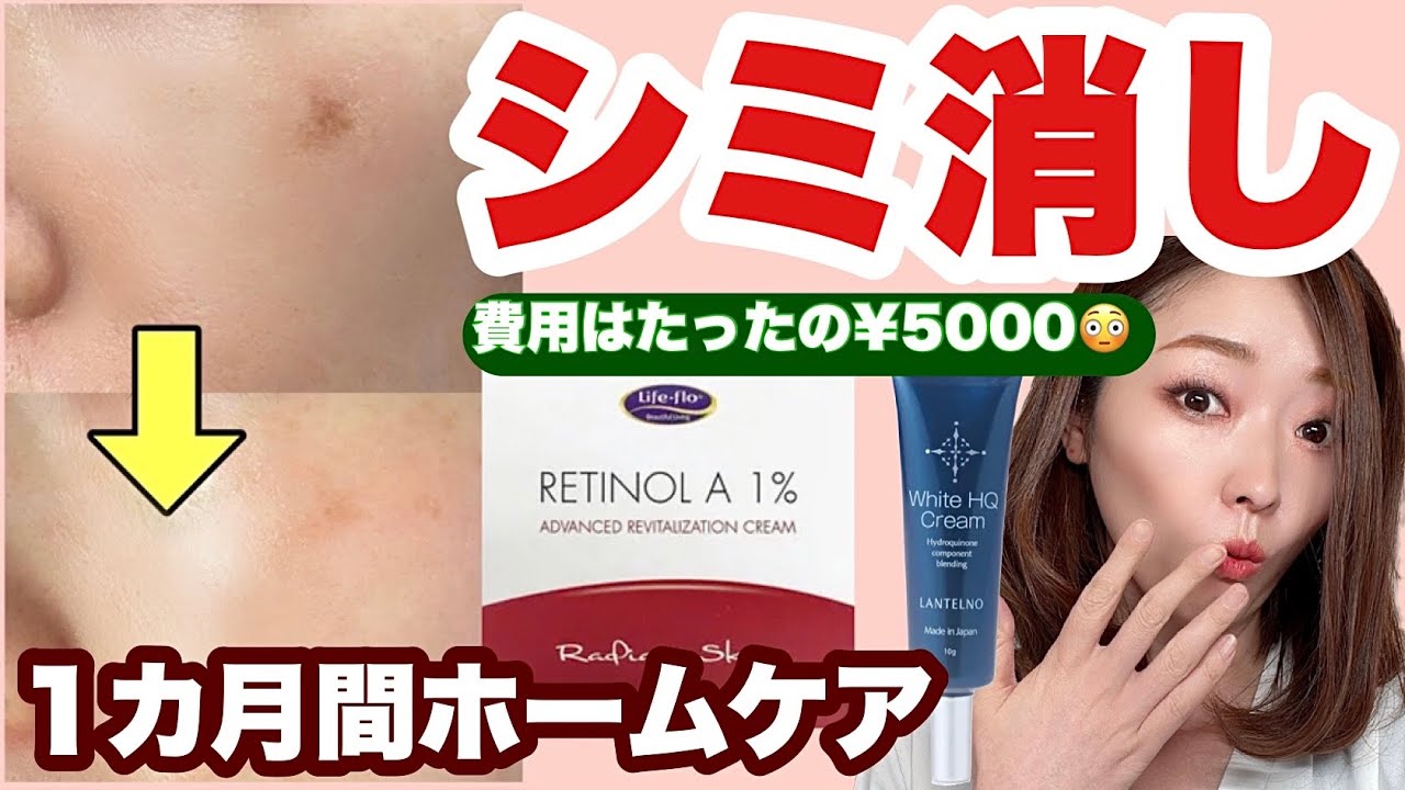 【おうちでシミを消す方法】1ヶ月で激変！セルフケアでもここまで変われました【スキンケア講師が実証】