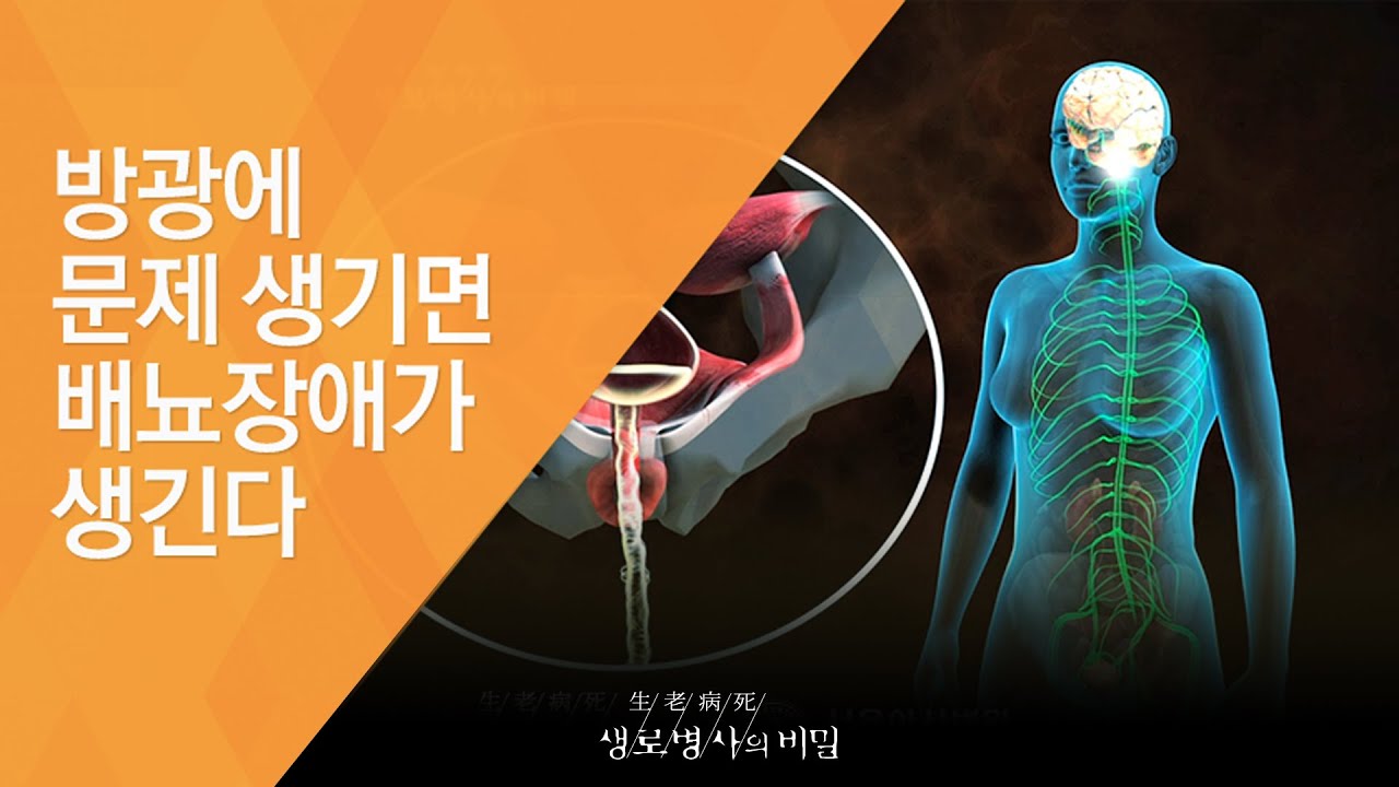 방광에 문제 생기면 배뇨장애가 생긴다 - (20121027_433회 방송)_말 못할 고민 - 배뇨장애