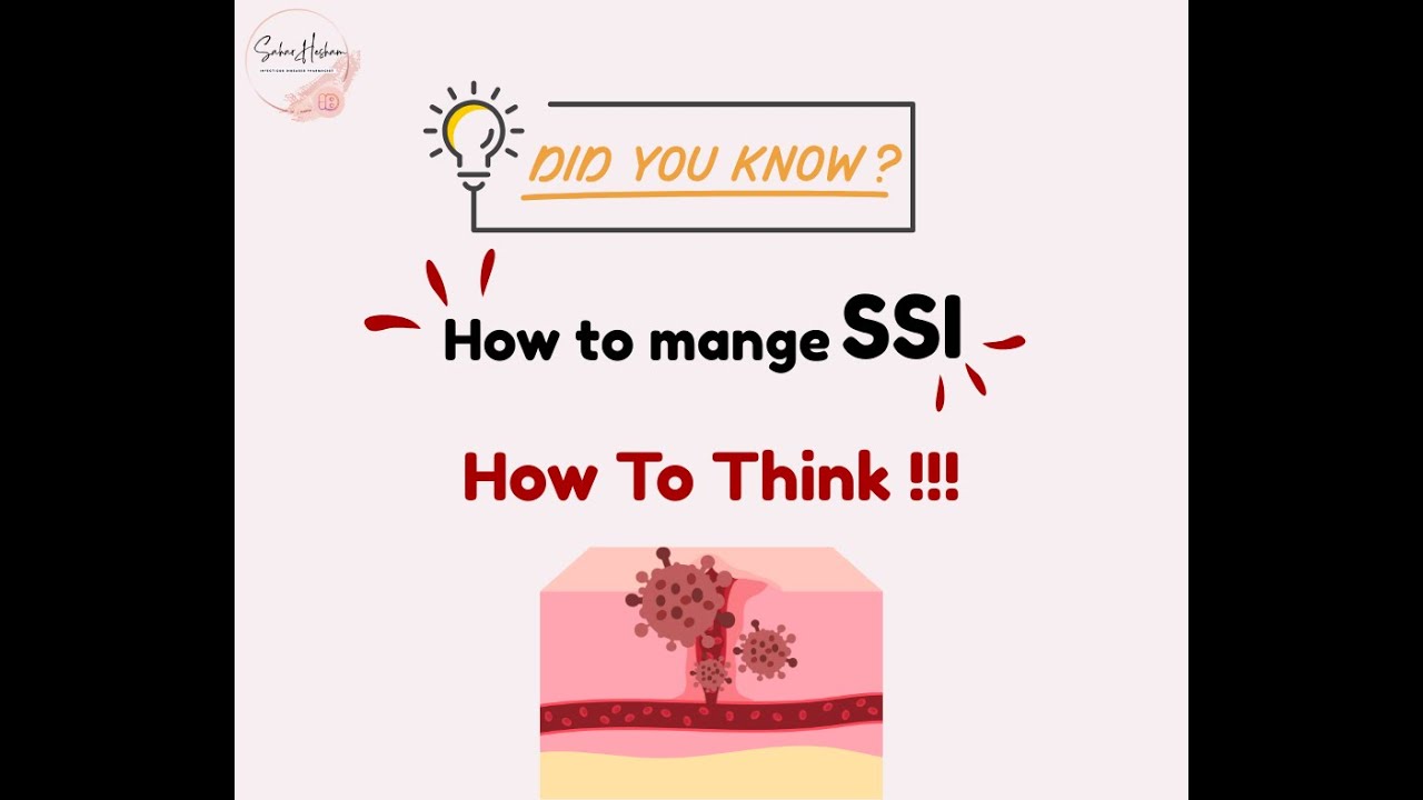 How to mange surgical site infection (Real patient case)
