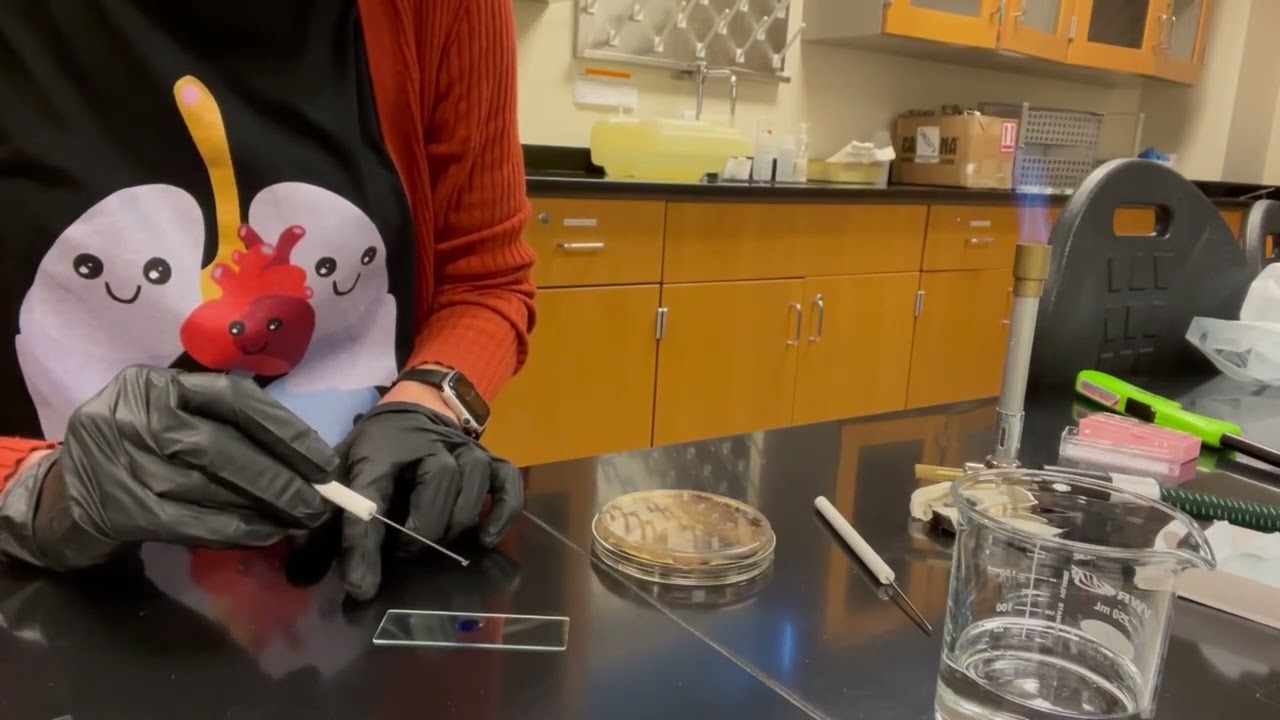 Staining Fungi