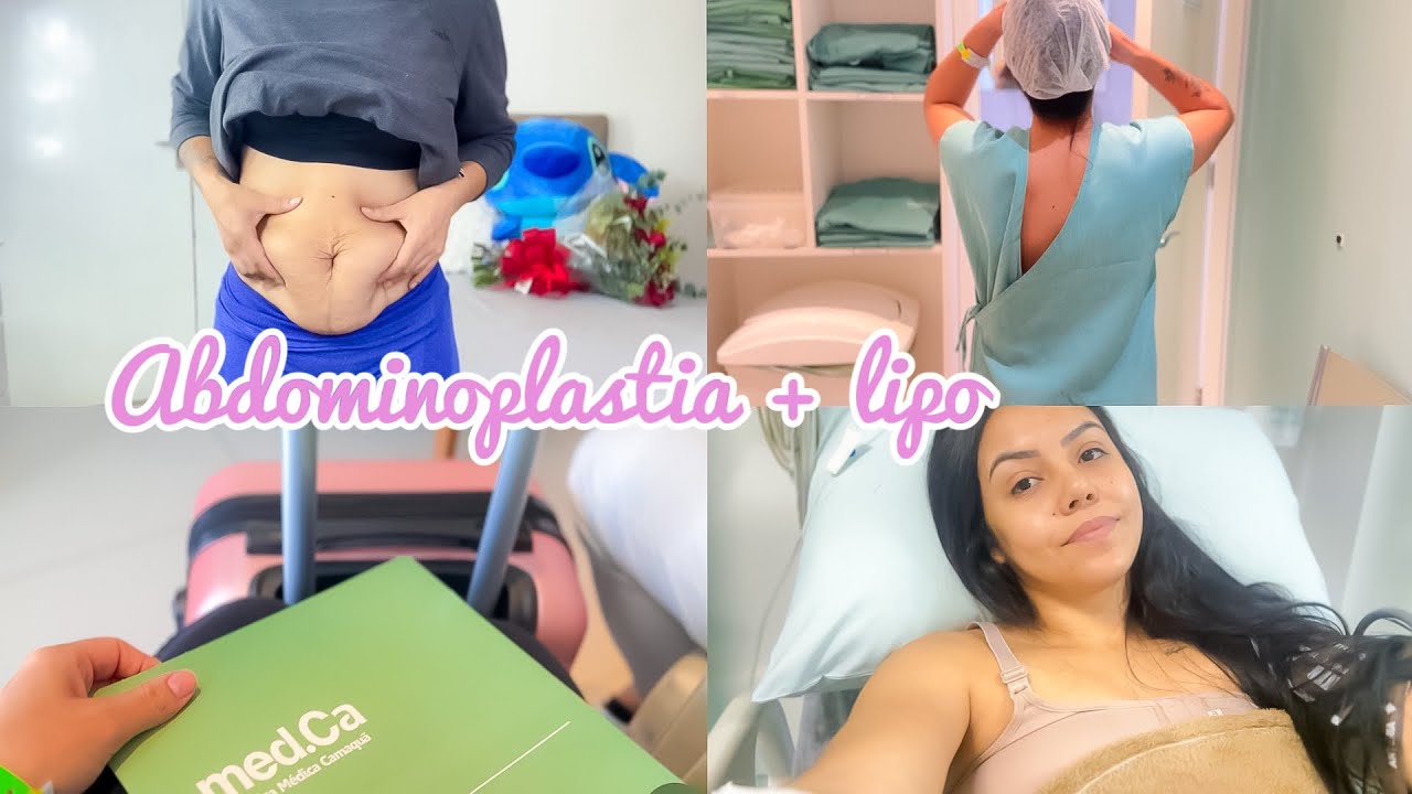 O DIA DA MINHA CIRURGIA 😭 LIPO + ABDOMINOPLASTIA