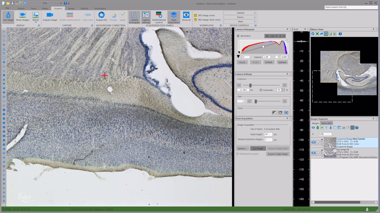 Brightfield imaging