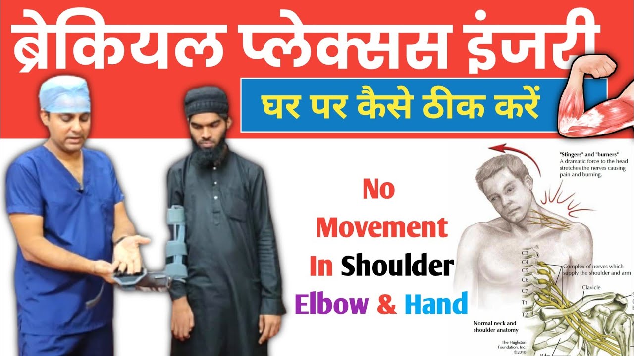 3 Best products for Exercises in Brachial Plexus Injury | ब्रेकियल प्लेक्सस इंजरी का इलाज घर पर करें