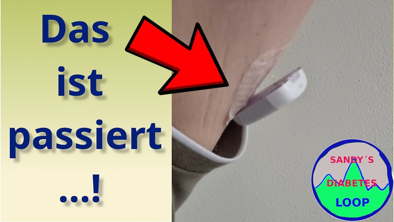 So klein, so smart! 💡 Metrum Nano A8: Funktionen, Befüllung & mein Fail 😅