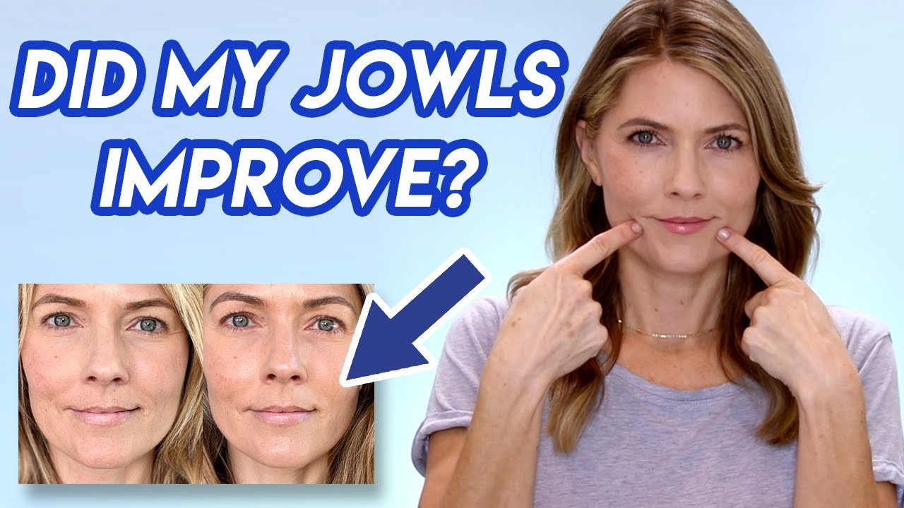 30 Day JOWLS RESULTS: How to Treat Jowls and Marionette Lines At Home with the Myolift Gloves