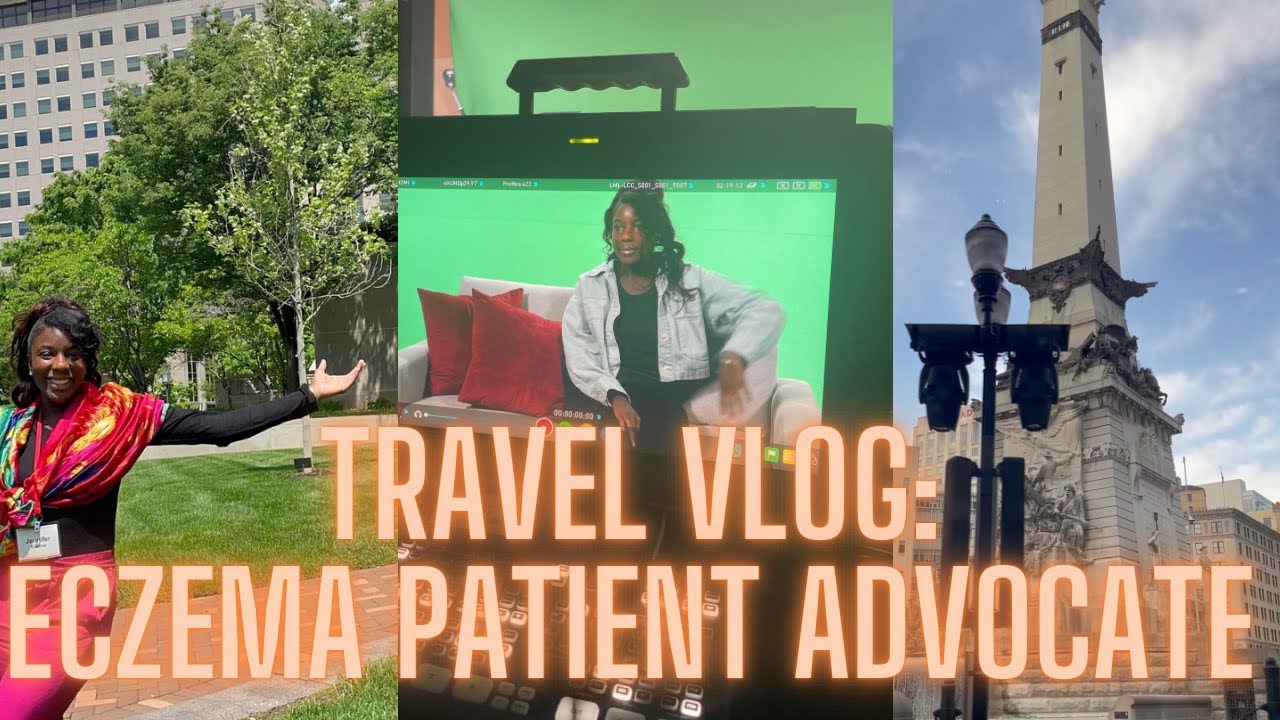 Travel Vlog: Eczema Patient Advocate
