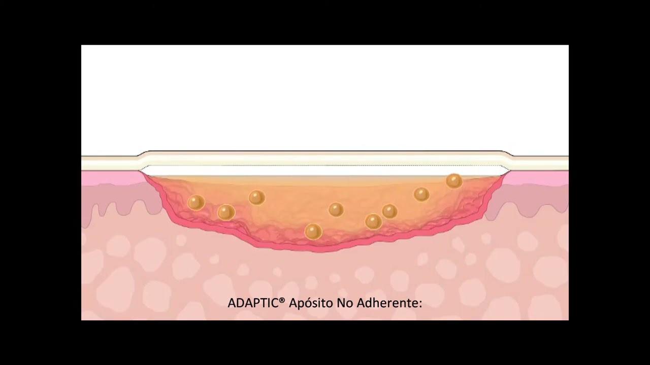 ADAPTIC Ap&oacute;sito No Adherente   C&oacute;mo funciona