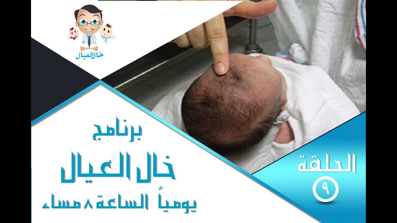 برنامج خال العيال I د.هانى عصام الحلقة التاسعة تعرفى ايه عن رأس طفلك ؟؟ اجابات مهمه
