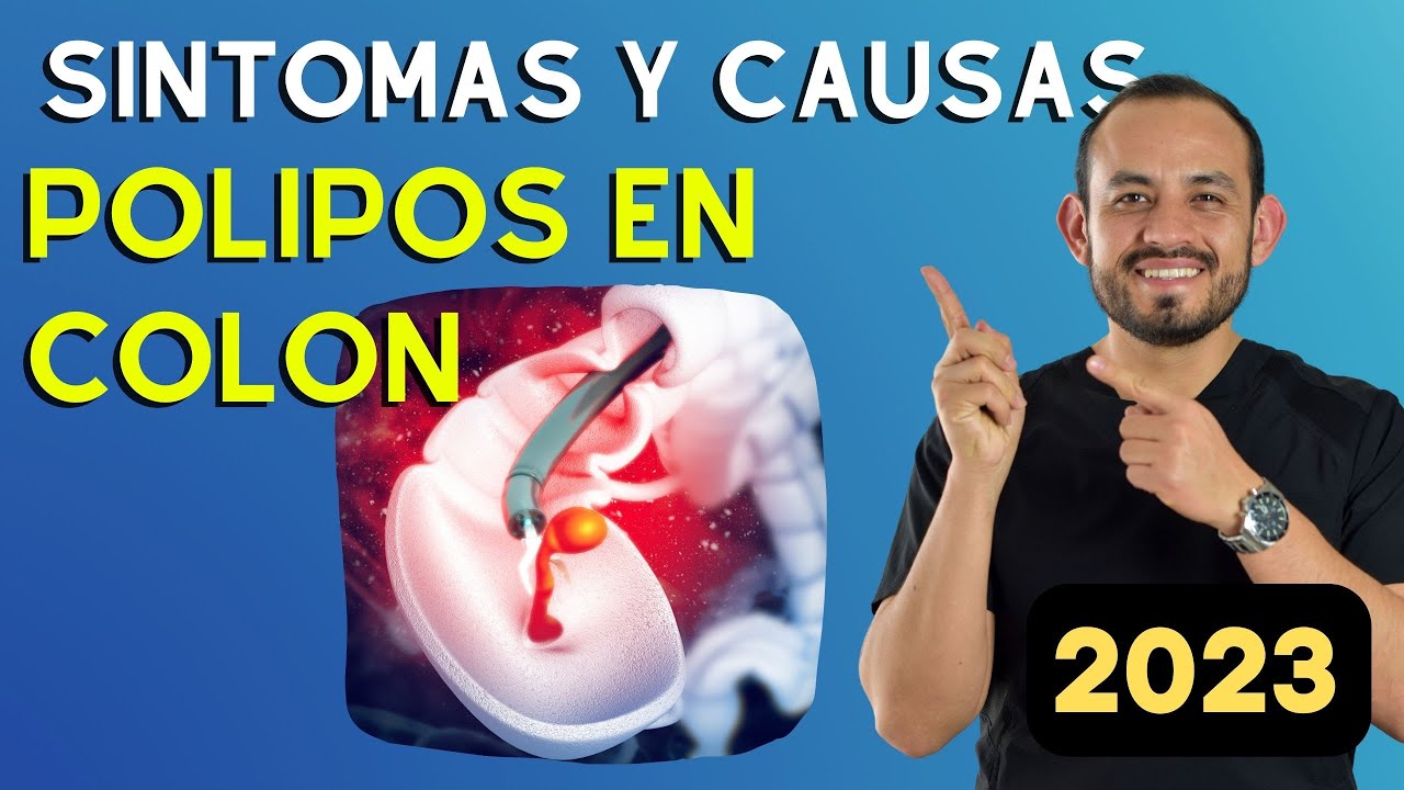 Pólipos: Síntomas, Causas, Diagnostico y Tratamiento | Dr Juan Pablo Hernández Parte 1