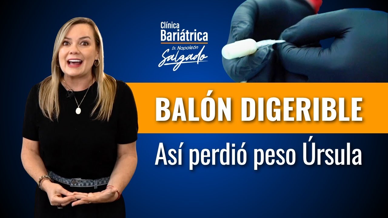 Úrsula bajó de peso en solo 2 meses con balón digerible: así fue su experiencia