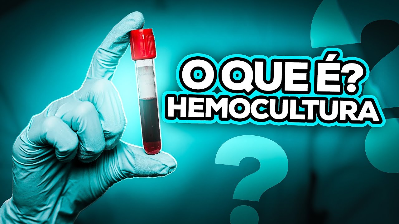 Hemocultura - O Que é Hemocultura e Como é Feita a Coleta
