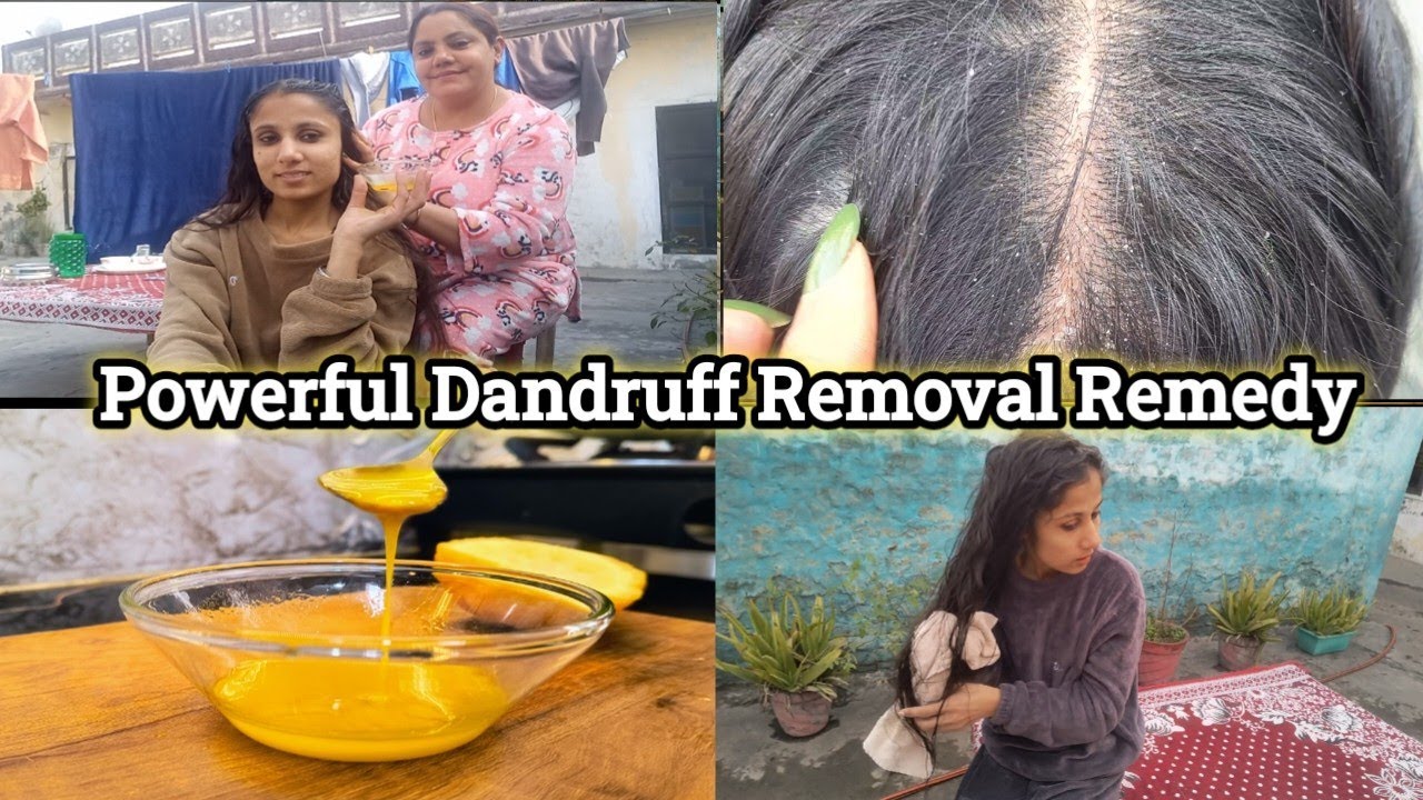 A Calm Haircare Vlog Day 💆‍♀️ | Home Chores + Dandruff Remedy that actually works 