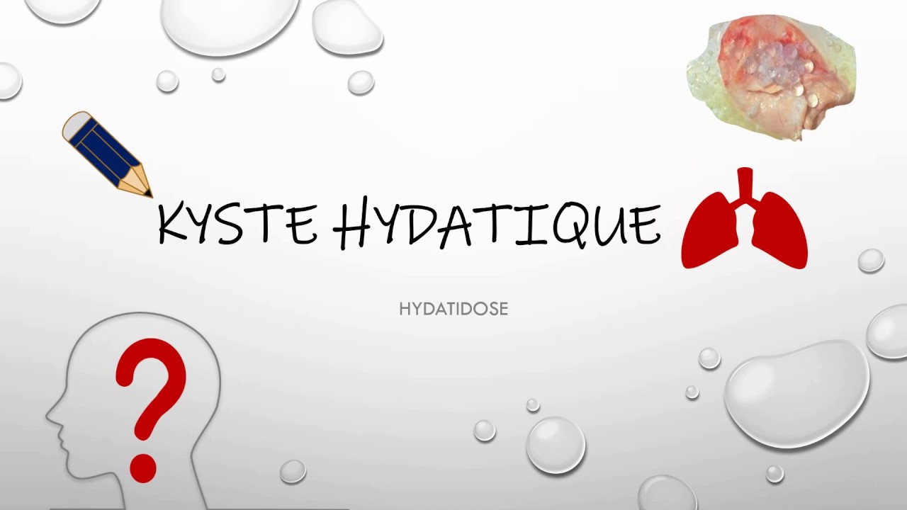 Kyste hydatique du poumon 😣 - Résumé - Pneumo.Phtisiologie