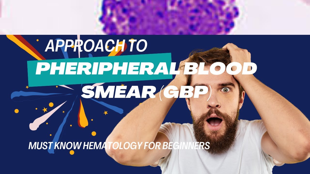 INTERPRETATION OF  PHERIPHERAL BLOOD  SMEAR | HOW TO REPORT A GBP