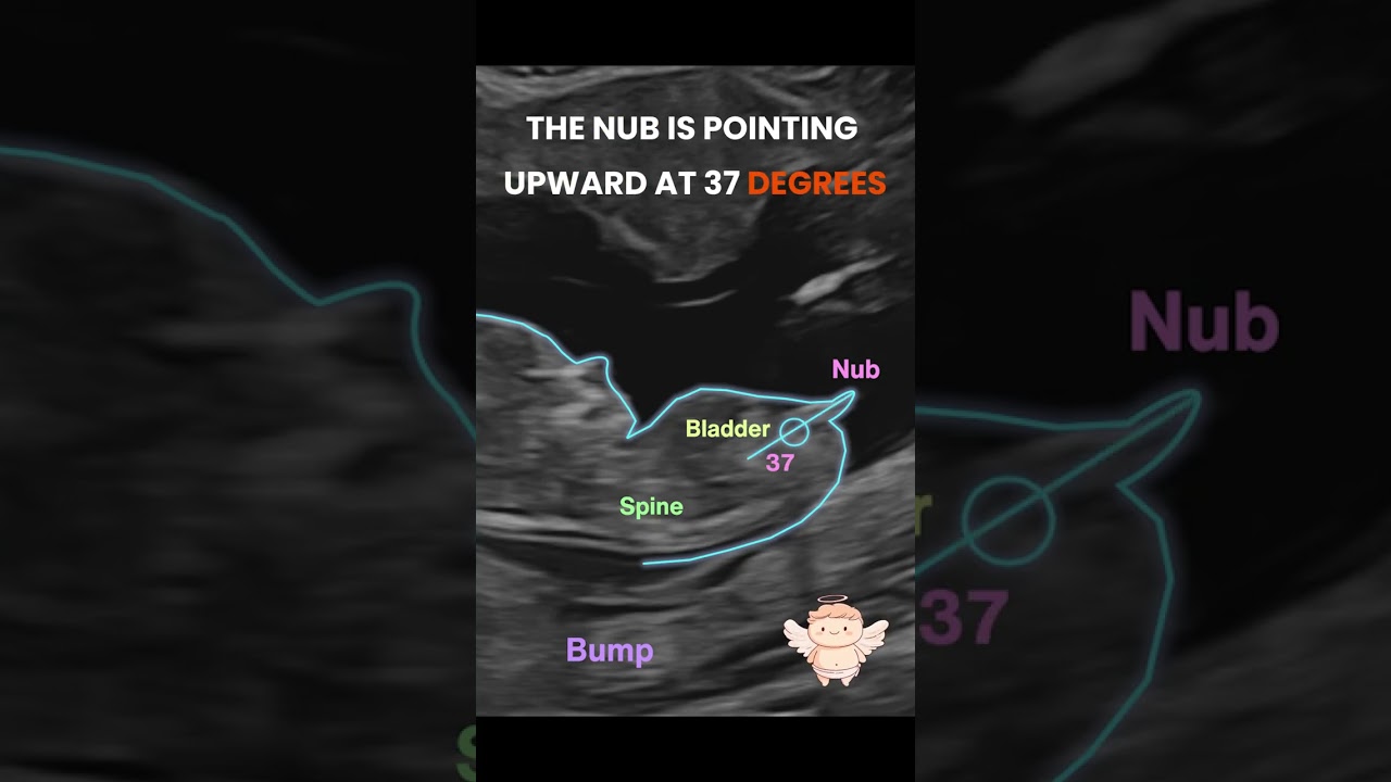 Gender reveal with NubX!