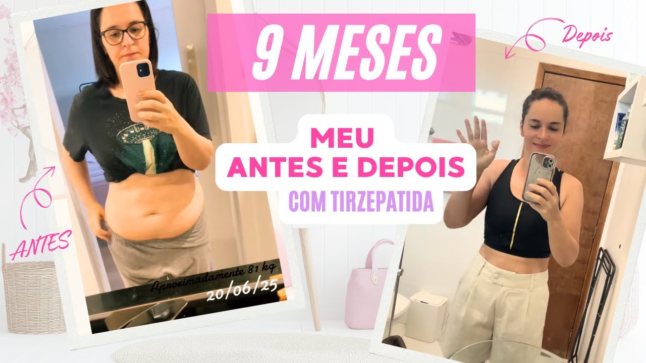 9 meses com Tirzepatida: meu antes e depois #mounjaro #tirzepatida #tirzec