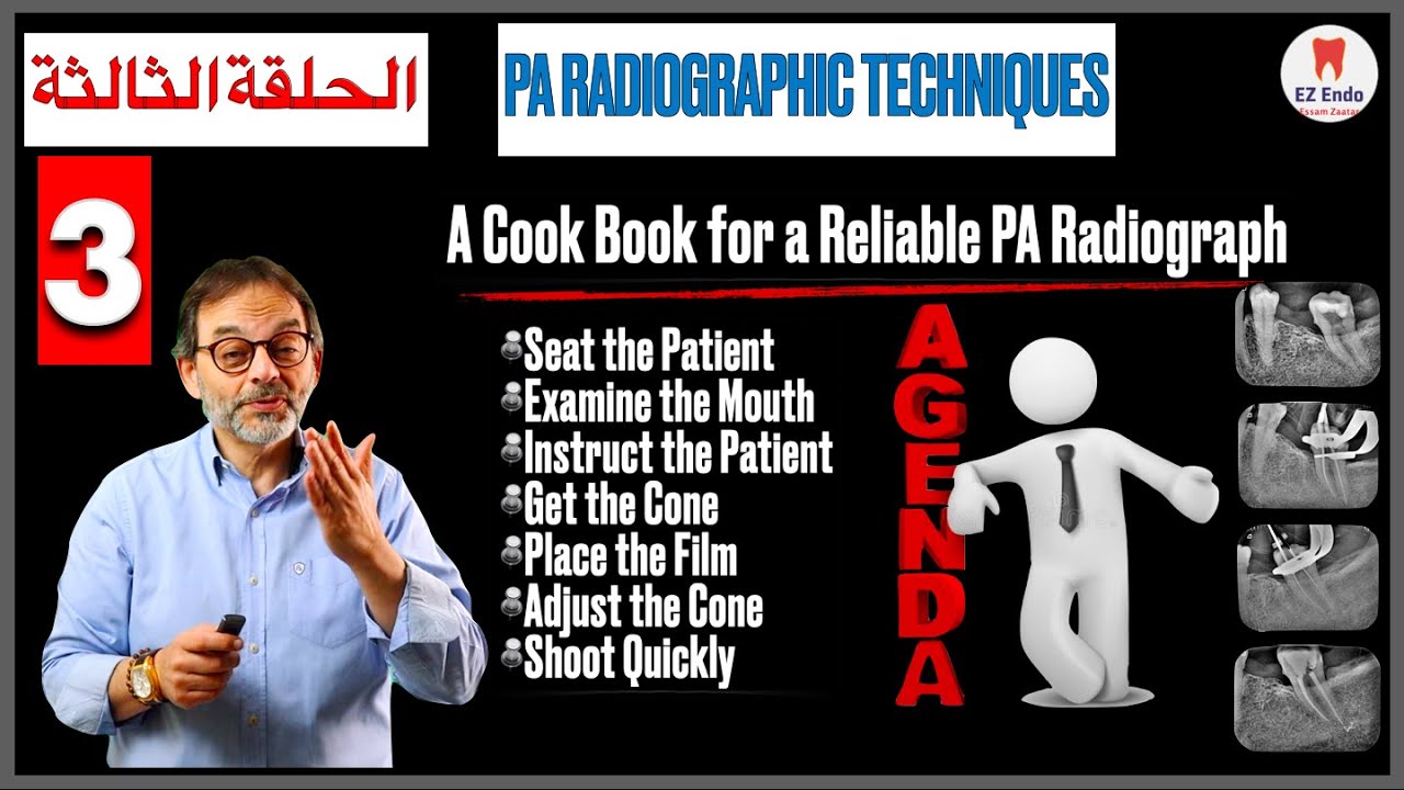 Taking Periapical Radiographs - III الحلقة الثالثة الأخيرة من تعلم الطرق السليمة لتصوير أشعة الأسنان