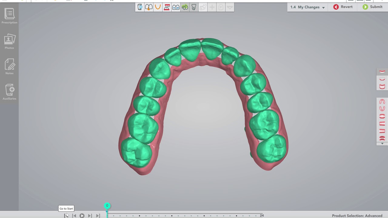 Learn How to  Perform the perfect treatment plan with Spark Aligners