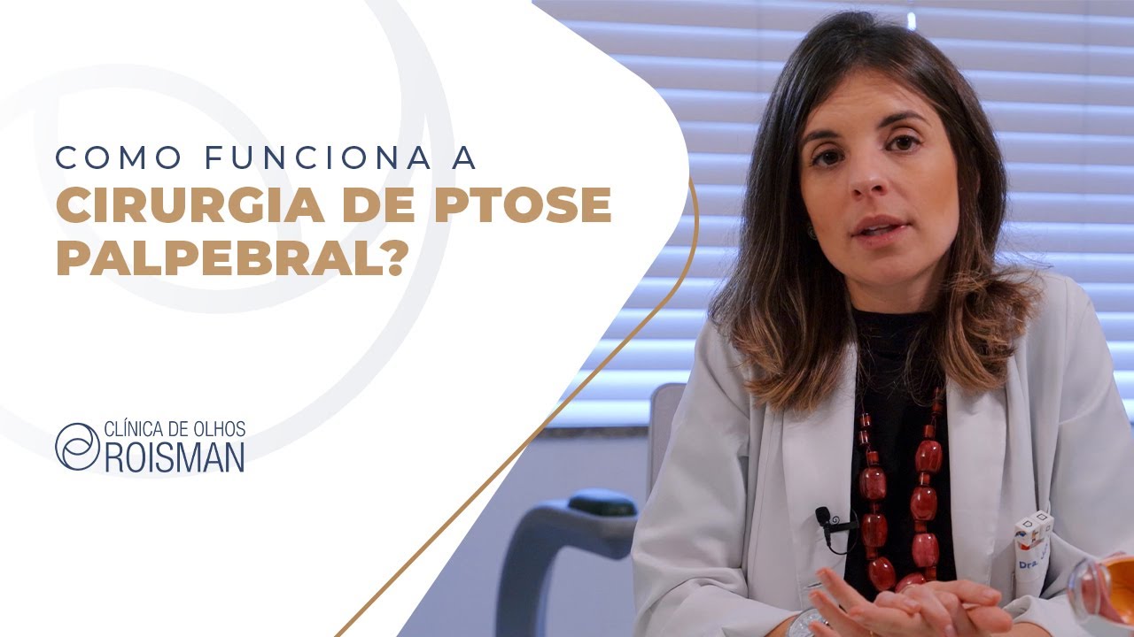 Cirurgia de Ptose: Como funciona e qual é o melhor momento para operar?