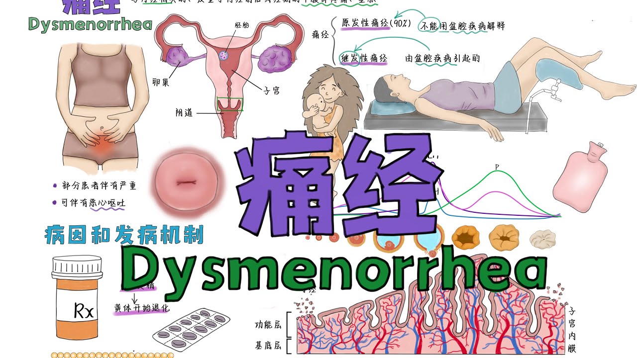 一口气搞懂【痛经】Dysmenorrhea病因和发病机制+症状+诊断+治疗药物机制（布洛芬/酮洛芬/萘普生/孟鲁司特/避孕药）+宫颈管扩张术+中药+艾灸+针灸
