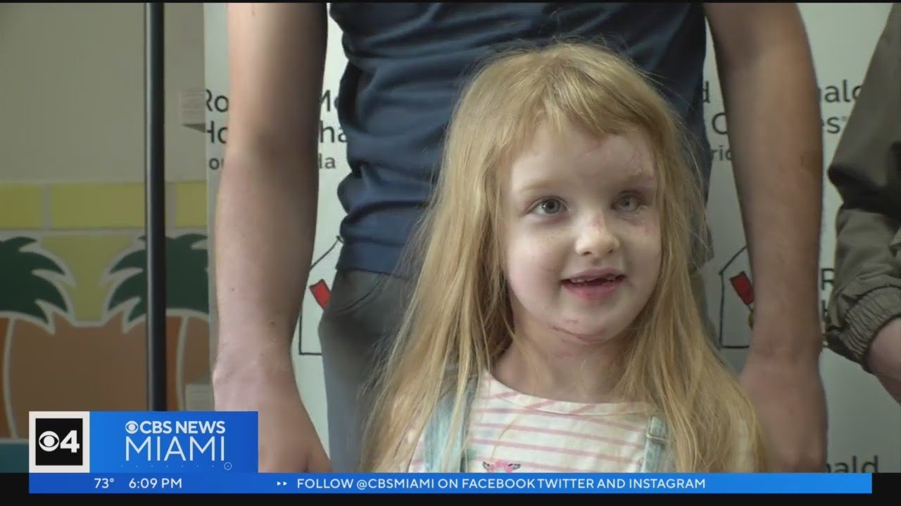 Ukrainian girl leaves hospital after being injured by Russian missile
