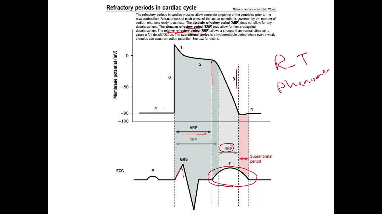 Critical Care Nursing - ECG Part 1