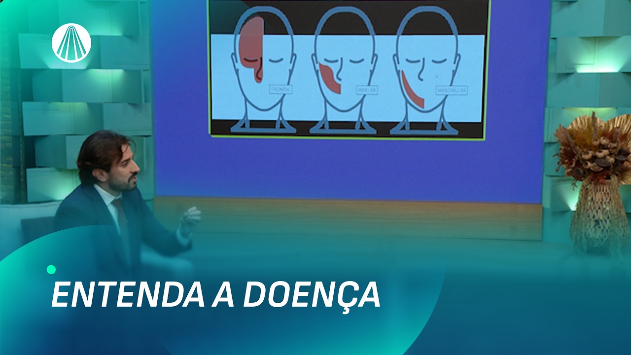 A Pior dor do mundo: entenda a Neuralgia do Trigêmeo | Viva a Tarde