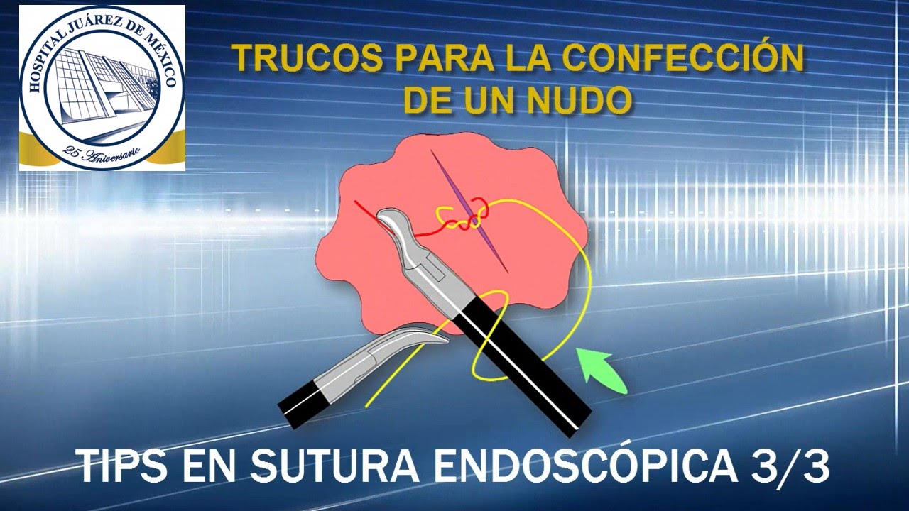 tips en sutura endoscópica 3/3 (anudado y suturas deslizantes)