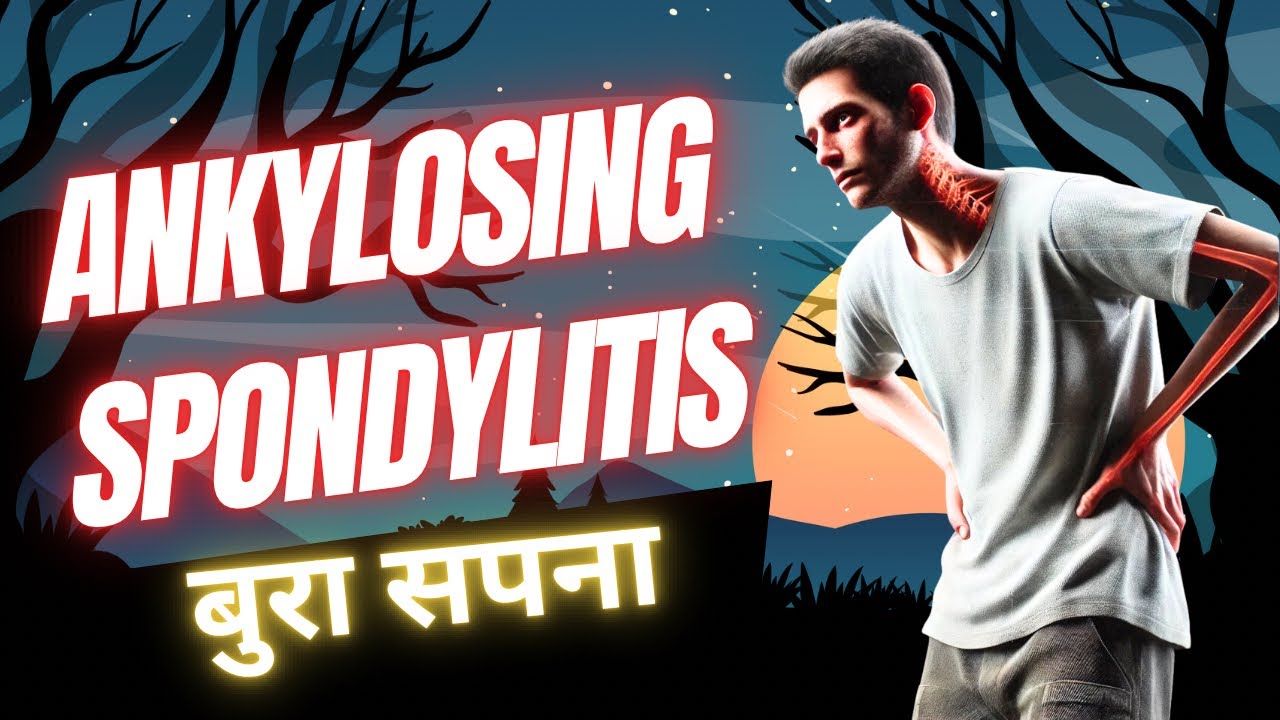Ankylosing spondylitis all you need to know  😱!! | Dr. Harish Grover