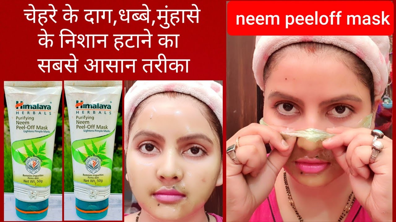 चेहरे के दाग धब्बे, मुंहासे के निशान हटाने का सबसे आसान तरीका | neem peel-off mask | RARA | Himalaya