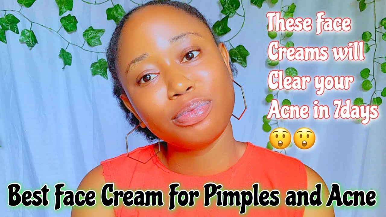 BEST FACE CREAMS FOR ACNE| PIMPLES Joy Ababah