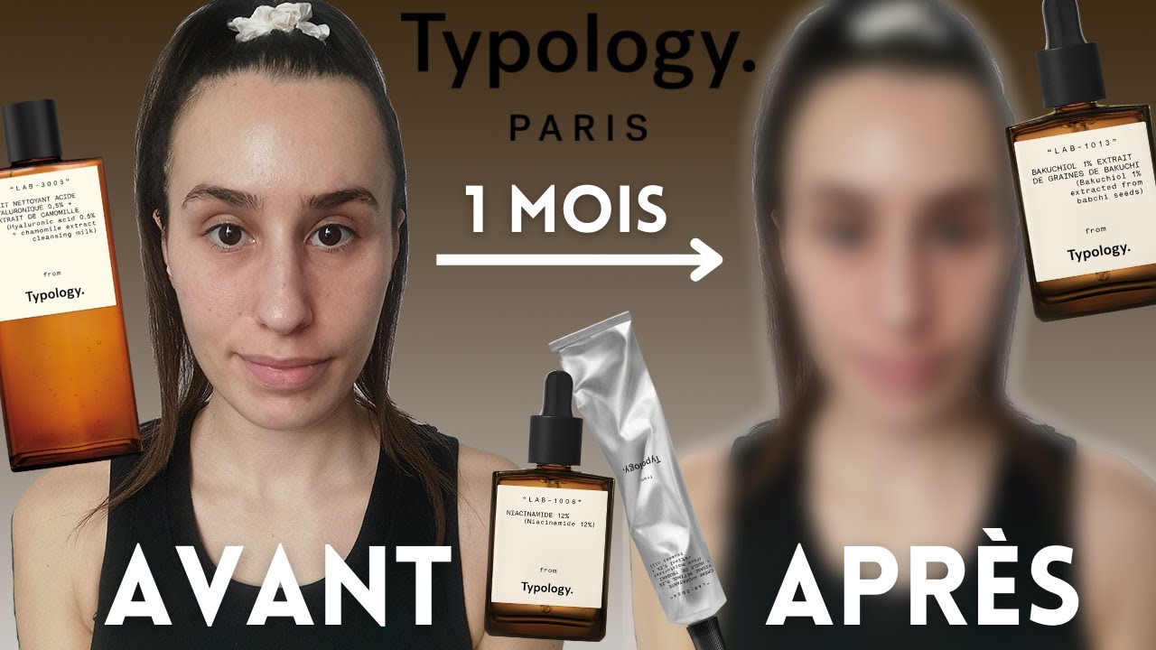 J’AI TESTÉ UNE ROUTINE ANTI IMPERFECTIONS & ANTI ROUGEURS AVEC TYPOLOGY PENDANT 1 MOIS