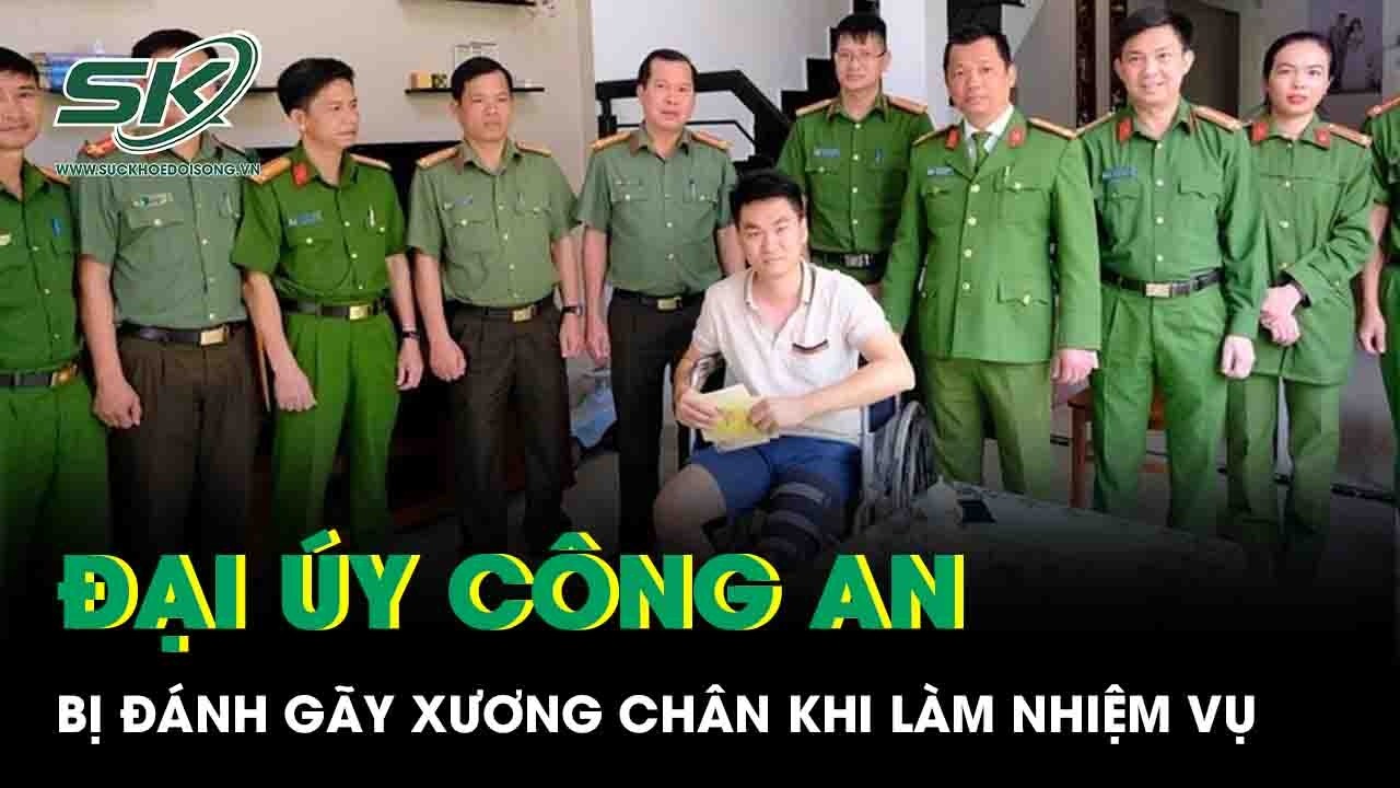 Bắt giữ kẻ dùng xà beng đánh gãy xương chân Đại úy công an ở Lâm Đồng