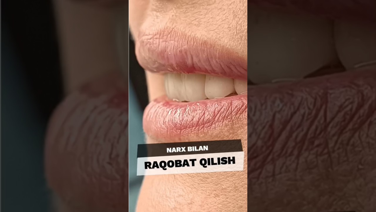 Narx bilan raqobat qilish 🔥