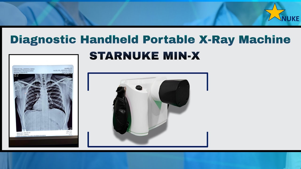 Diagnostic Handheld Portable X-Ray Machine STARNUKE MIN-X