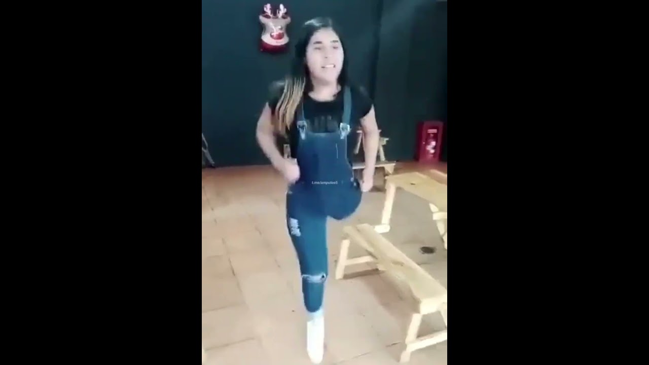 amputee