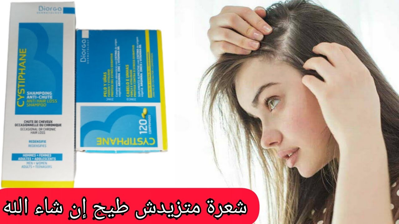 لي شعرها راه يطيح بزاف ومعرفش الحل هذي وصفة طبية معجزة كبيرة بمعنى الكلمة ستخدميها على ضمانتي 💯مجربة