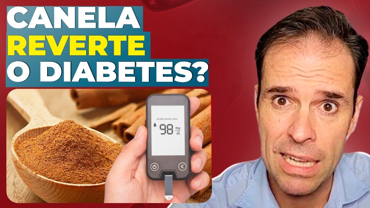 CANELA FAZ MILAGRES NO DIABETES? SERÁ?