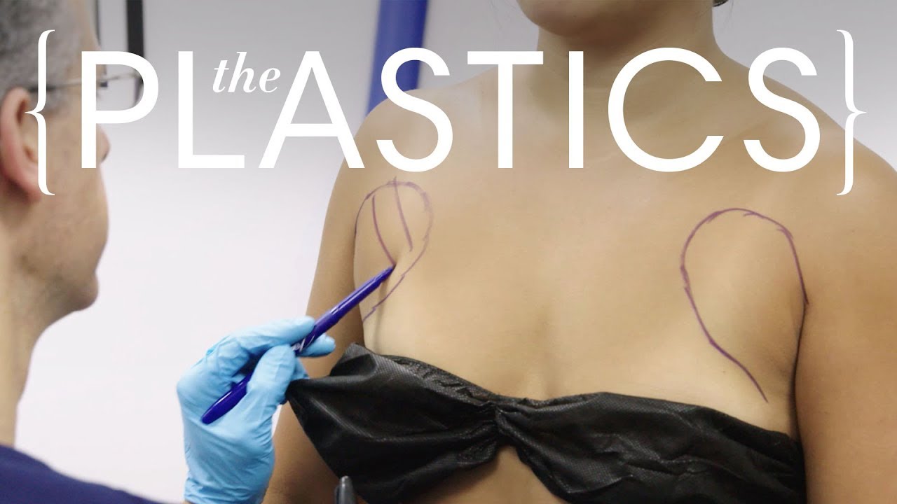 This $5,000 Laser Removes Fat From Your Armpit | The Plastics | Harper's BAZAAR