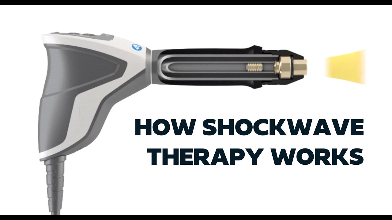 How Extracorporeal Shockwave Therapy Works