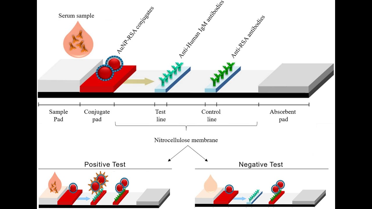 Lec 3: Lateral Flow Immunosay
