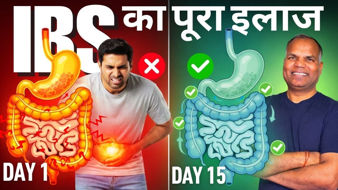 15 Days में IBS का इलाज! क्या खाएं, क्या न खाएं? IBS Diet plan by Ramesh Chandra